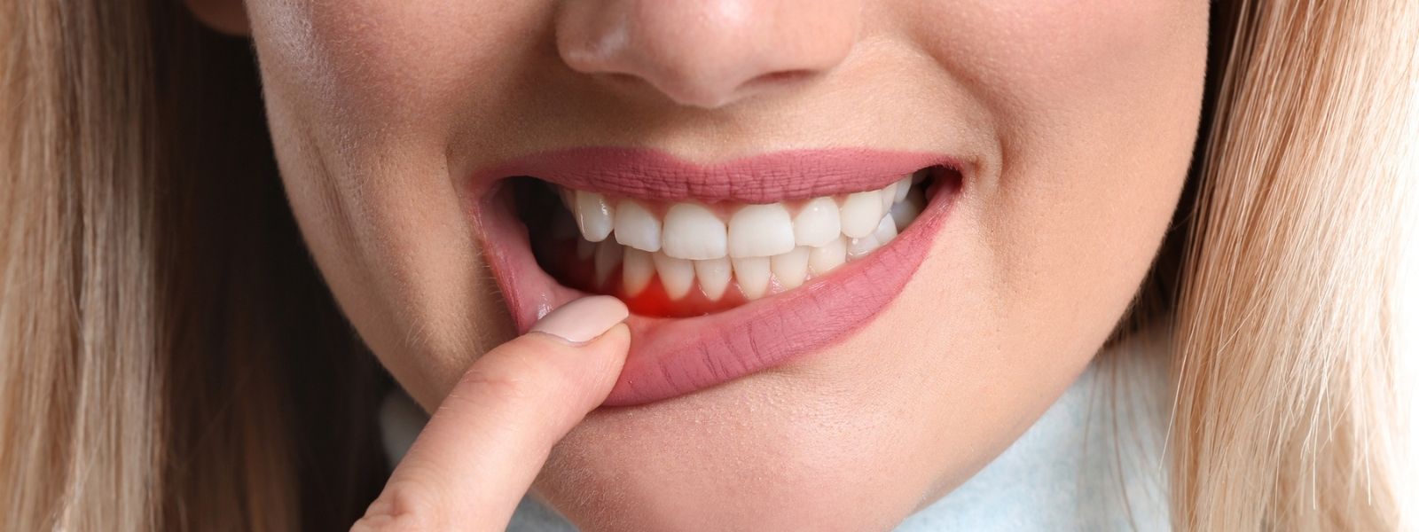 Girl with nice teeth showing gum.
